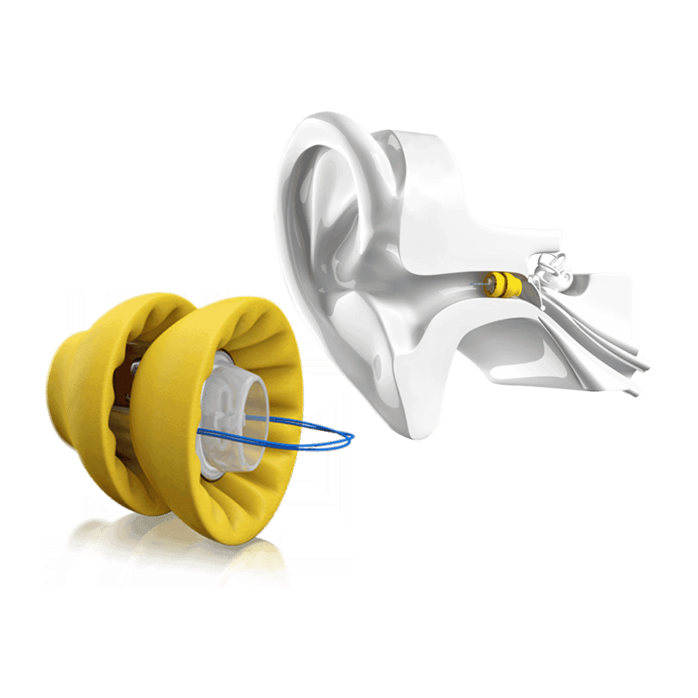 Banner Image of Lyric hearing aid