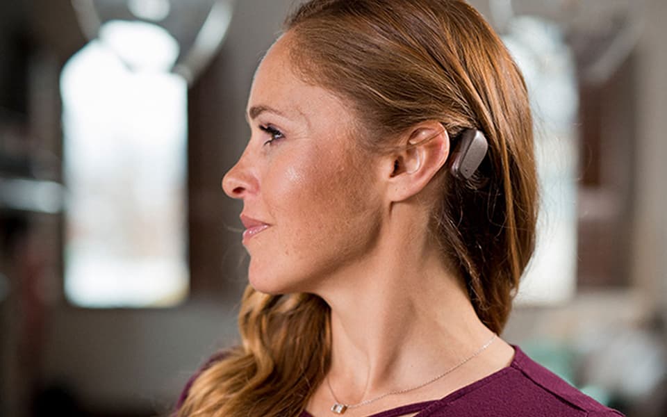 Bone anchored hearing systems